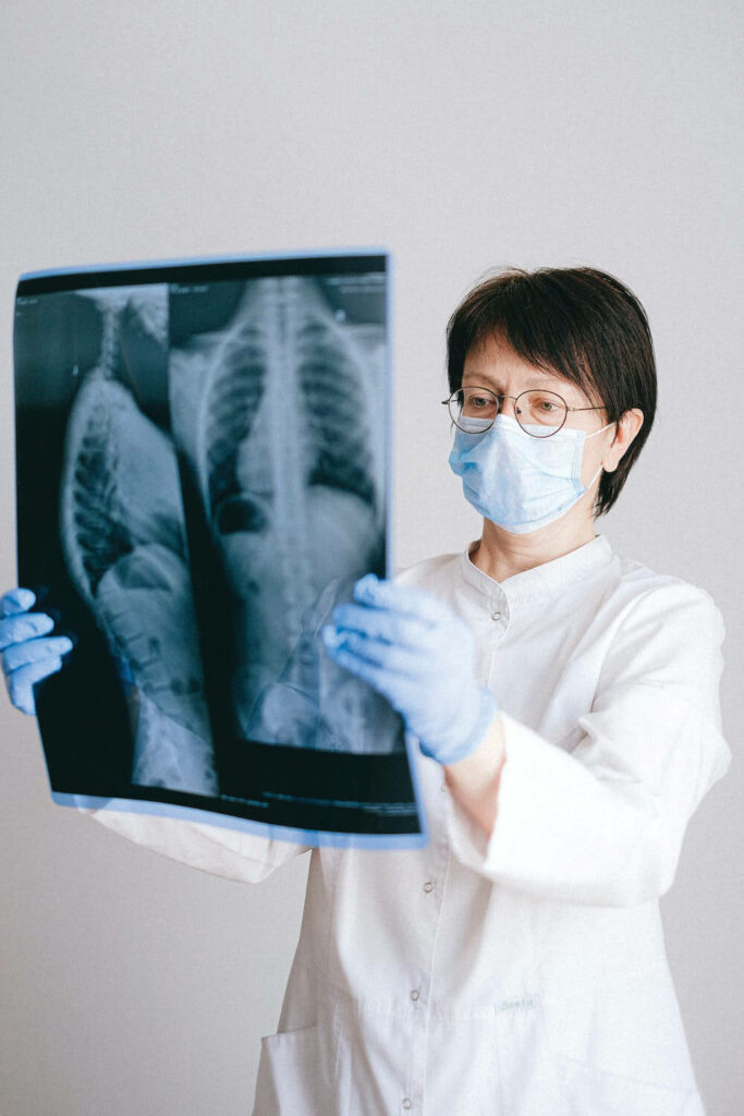 a doctor is looking at a lung image.